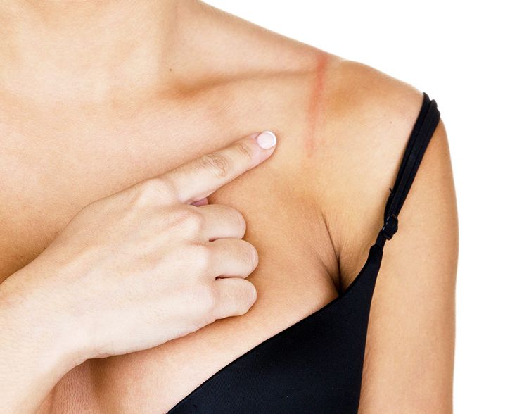 7 Signs Your Bra Is a Red Flag, (and Why It’s Time for a Glow-Up)